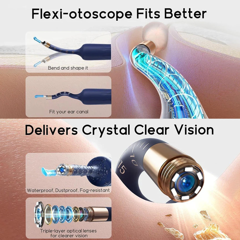 Ear Cleaner Tool Kit, Ear Wax Removal with HD Camera & WiFi Connection, Flexible Otoscope Camera Light for iOS & Android, Safe Ear Cleaning for Adults & Baby