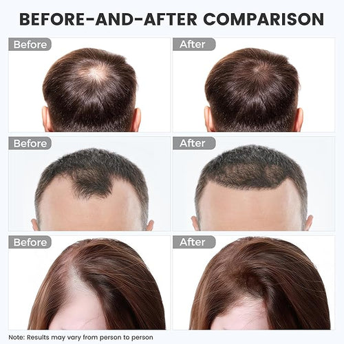 Best Red Light Therapy Cap for Hair Growth & Hair Fall Reduction