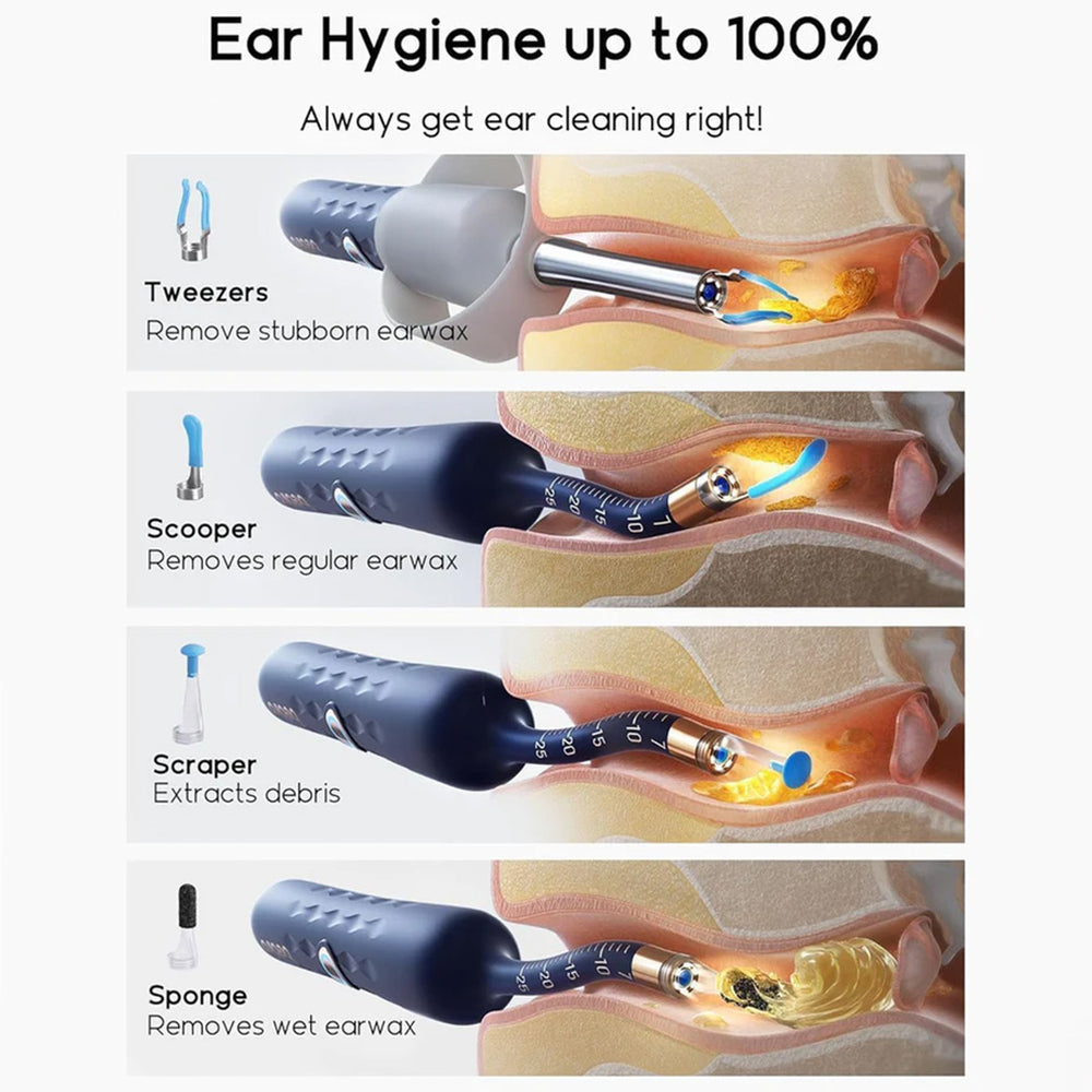 Ear Cleaner Tool Kit, Ear Wax Removal with HD Camera & WiFi Connection, Flexible Otoscope Camera Light for iOS & Android, Safe Ear Cleaning for Adults & Baby