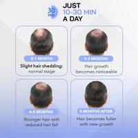 Red Light Therapy Hair Growth Cap - Stop 100% Hair Fall Reduction - Advance Laser Cap for Hair Growth - For Men & Women