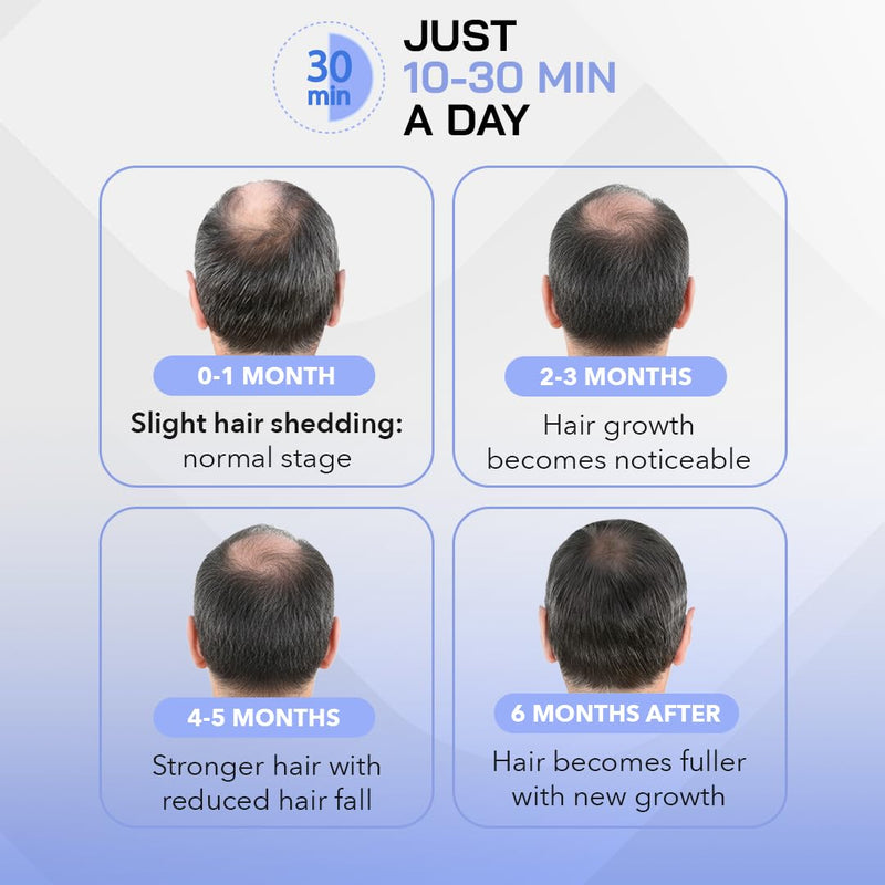 Red Light Therapy Hair Growth Cap - Stop 100% Hair Fall Reduction - Advance Laser Cap for Hair Growth - For Men & Women