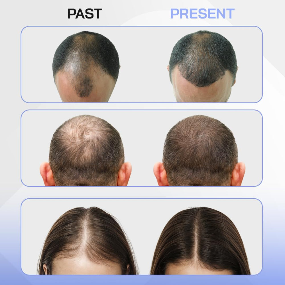 Red Light Therapy Hair Growth Cap - Stop 100% Hair Fall Reduction - Advance Laser Cap for Hair Growth - For Men & Women