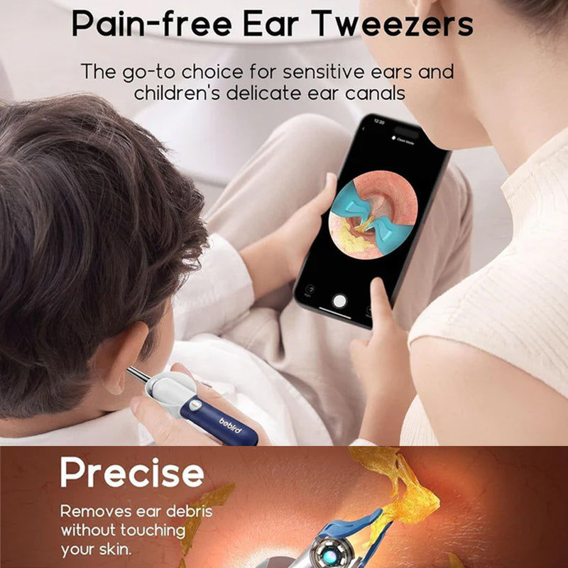 Ear Cleaner Tool Kit, Ear Wax Removal with HD Camera & WiFi Connection, Flexible Otoscope Camera Light for iOS & Android, Safe Ear Cleaning for Adults & Baby