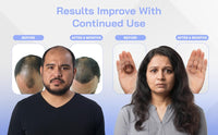 Red Light Therapy Hair Growth Cap - Stop 100% Hair Fall Reduction - Advance Laser Cap for Hair Growth - For Men & Women