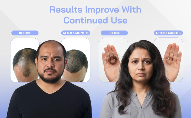 Red Light Therapy Hair Growth Cap - Stop 100% Hair Fall Reduction - Advance Laser Cap for Hair Growth - For Men & Women